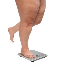 How BMI and Foot Conditions May Be Related
